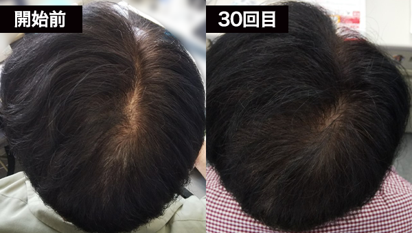 Nさん BeforeAfter