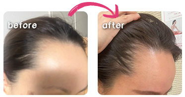 ビフォーアフター