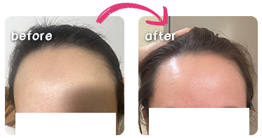 ビフォーアフター