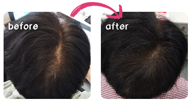 ビフォーアフター