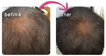 ビフォーアフター