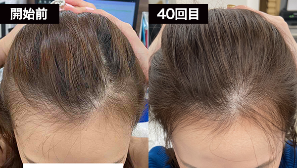 Wさん BeforeAfter