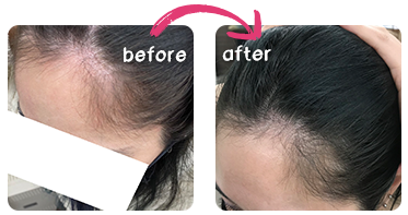 ビフォーアフター