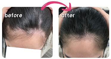 ビフォーアフター