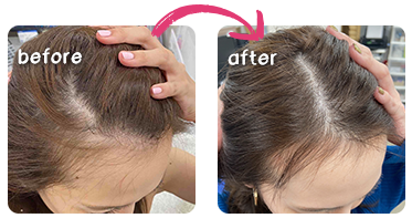 ビフォーアフター