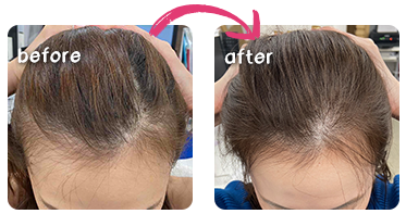 ビフォーアフター